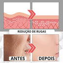 Botox Up Sérum Anti-Envelhecimento - LANÇAMENTO 2023