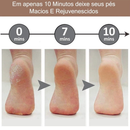 Removedor de Rachaduras e Calos nos Pés - PinkPerfect